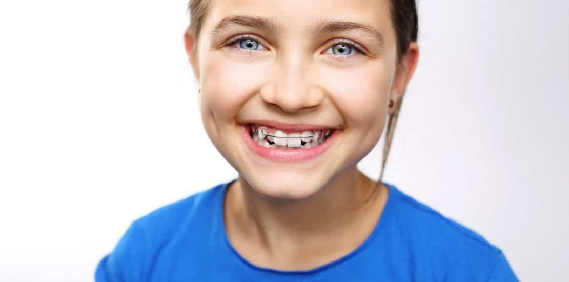 Children with Braces