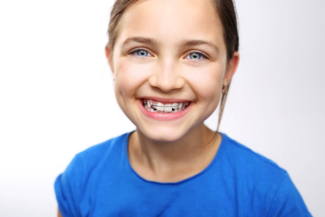Great School Lunch Ideas for Your Children with Braces - Modern
