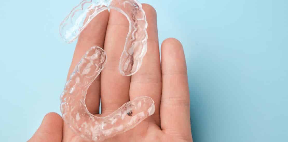 are clear aligners worth it