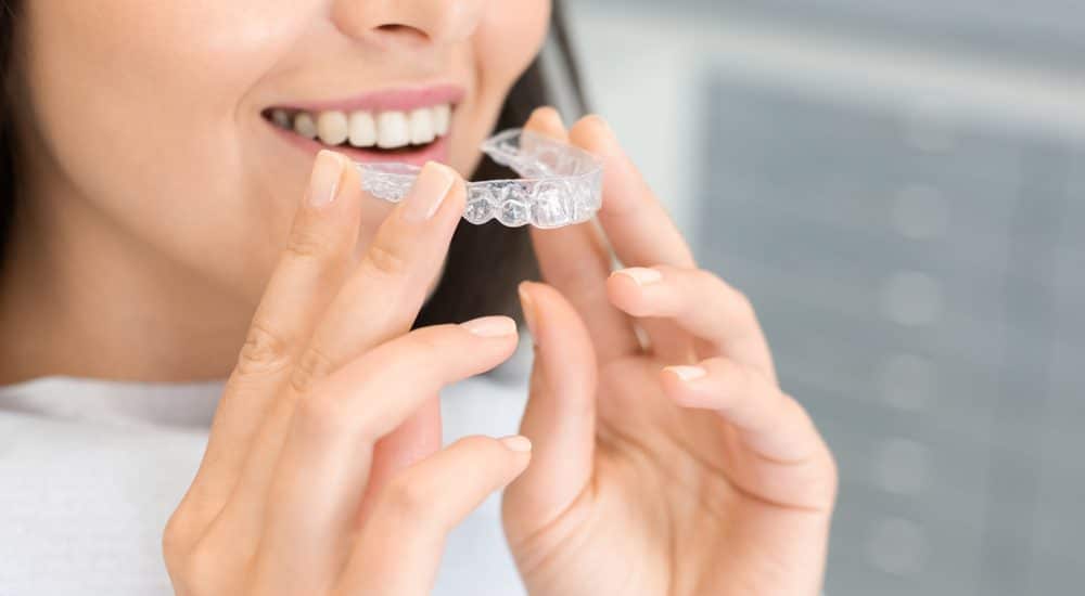 benefits of clear aligners